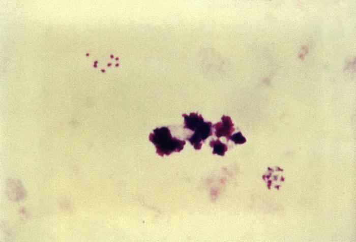 Thick film Giemsa stained micrograph depicts a mature Plasmodium malariae schizont Adapted from Public Health Image Library (PHIL), Centers for Disease Control and Prevention.[6]