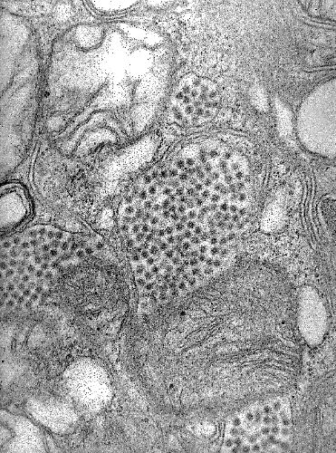 Electron micrograph of the Eastern Equine Encephalitis virus in a mosquito salivary gland; Alphavirus. From Public Health Image Library (PHIL). [1]