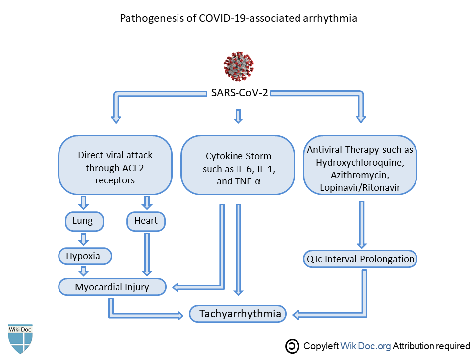 File:COVID-19 arrhythmia pathogenesis.png