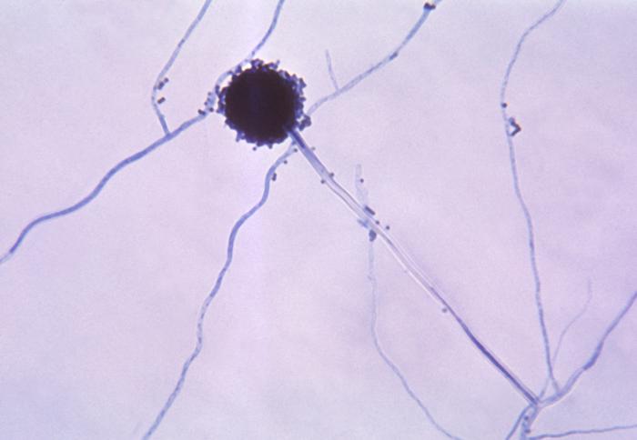 Conidial head of an Aspergillus niger fungal organism showing a double row of sterigmata. From Public Health Image Library (PHIL). [1]