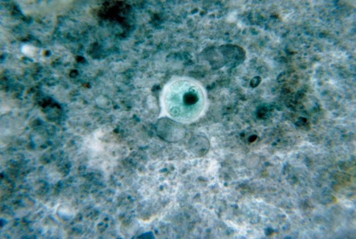 Entamoeba histolytica. Adapted from Public Health Image Library (PHIL). [1]