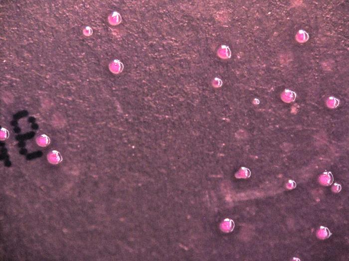 Yersinia pestis bacteria cultured on a cefsulodin-Irgasan-novobiocin (CIN) agar medium 48hrs (20x mag). Adapted from Public Health Image Library (PHIL), Centers for Disease Control and Prevention.[6]