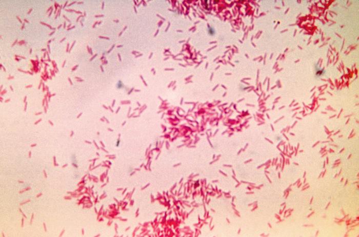 File:Fusobacterium18.jpeg