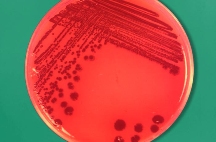 This image depicts a Petri dish culture plate containing a medium of blood agar to which menadione had been added. The dish had been inoculated with Prevotella melaninogenica, formerly known as Bacteroides melaninogenicus bacteria, which was incubated at a temperature of 35°C for a five day period. From Public Health Image Library (PHIL). [7]