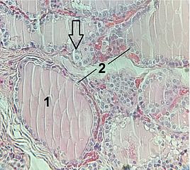 File:Histology thyroid gland.jpg