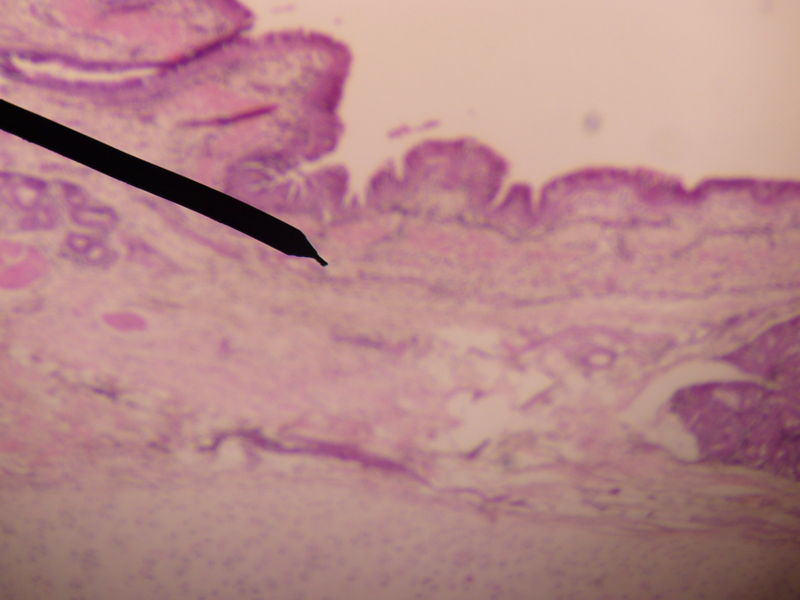 Microscopic cross section of human trachea.