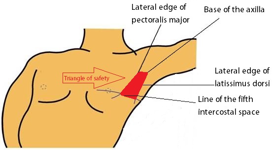 File:Triangle of safety-1.jpg