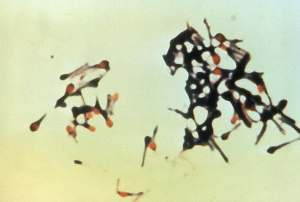 Clostridium tetani with characteristic 'tennis racket' appearance.