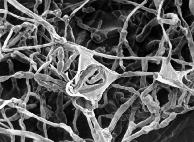 SEM reveals some of the ultrastructural morphology this pigmented, or dematiaceous mould, Xylohypha nigrescens, know to cause phaeohyphomycosis, chromoblastomycosis, and mycetoma. From Public Health Image Library (PHIL). [2]