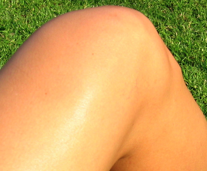 Female knee