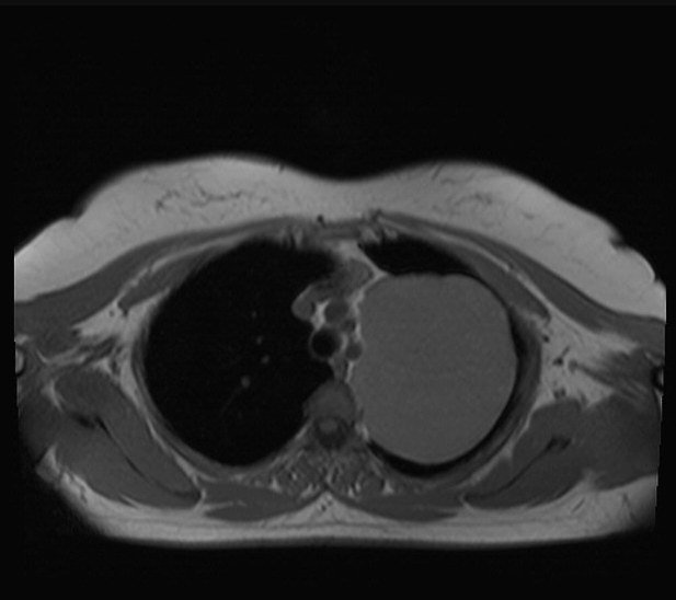 File:MRI at the level of T1 (1).png