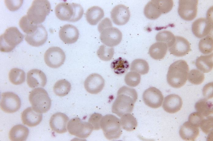 Thin film blood smear micrograph depicts a mature Plasmodium malariae schizont, which contains nine merozoites Adapted from Public Health Image Library (PHIL), Centers for Disease Control and Prevention.[6]