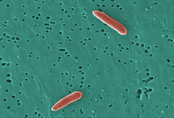 File:Bacteroides16.jpeg