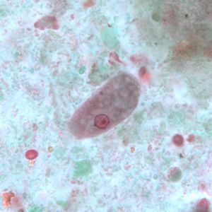 File:E coli troph BAM1.jpg