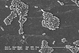 SEM micrograph of Escherichia coli bacteria.