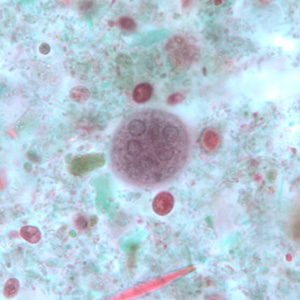File:E coli cyst BAM1b.jpg