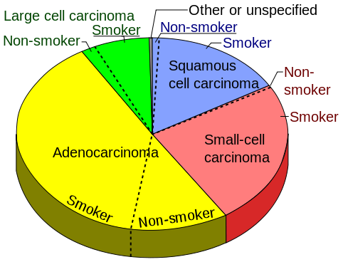 File:482px-Pie chart of lung cancers.svg.png