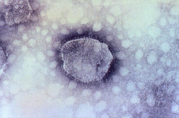Arenavirus (electron micrograph). Adapted from Public Health Image Library (PHIL). [2]