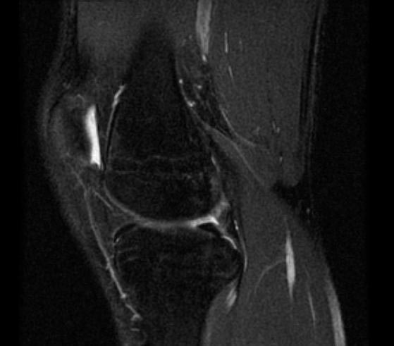 File:Normal-knee-MRI-002.jpg