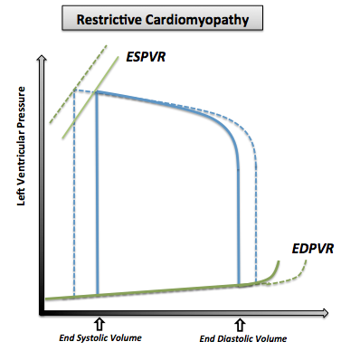 The pressure volume curve in restrictive cardiomyopathy. Note that the normal pressure volume diagram is in dotted line.