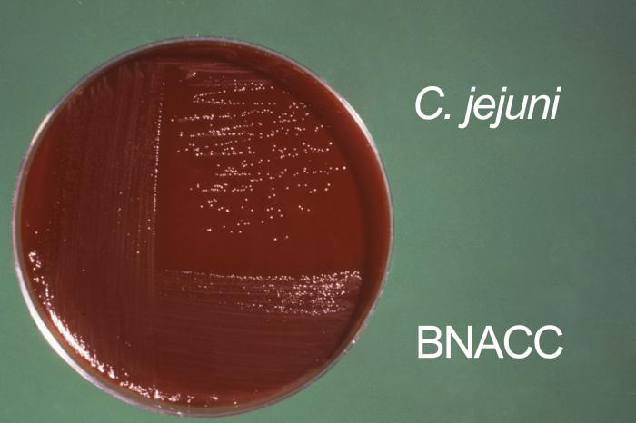 Campylobacter jejunii, formerly known as C. fetus subsp. jejuni, culture was grown on Skirrow's and Butzler's medium. From Public Health Image Library (PHIL). [2]