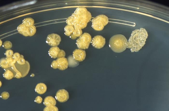 Trypticase soy agar plate culture of Enterobacter sakazakii showing wrinkled colonies 72hrs. From Public Health Image Library (PHIL). [7]