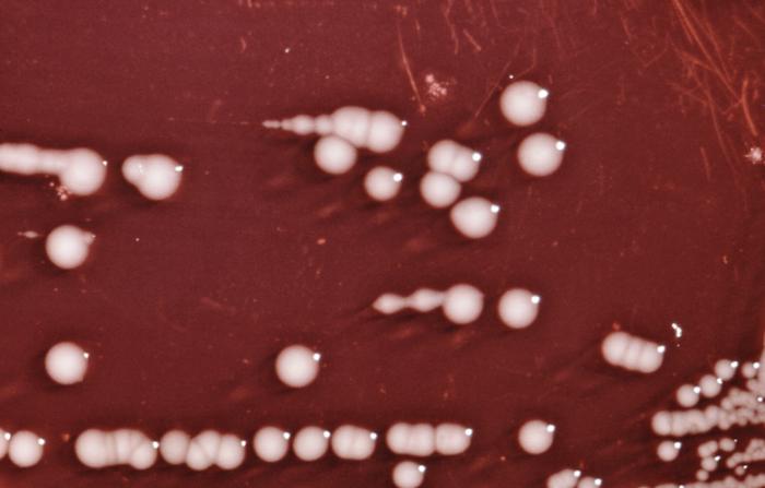 Providencia alcalifaciens bacteria cultured on a blood agar plate (BAP). From Public Health Image Library (PHIL). [6]
