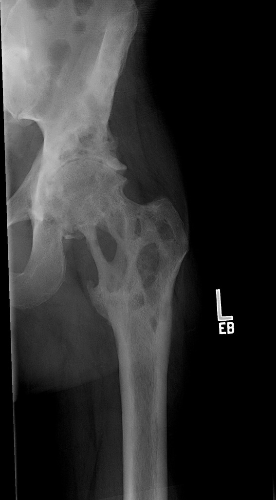 File:Langerhans X ray.jpeg
