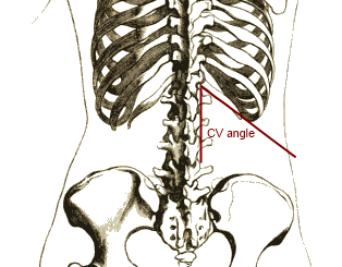 File:CVangle.png