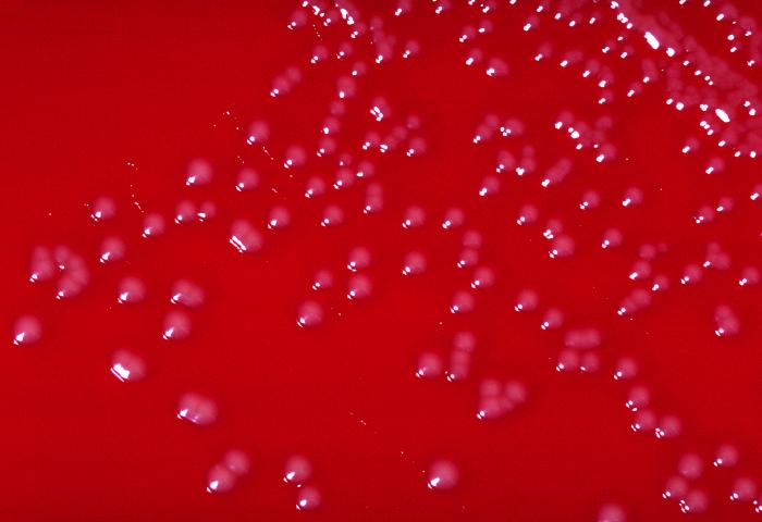 Blood agar culture is growing colonies of Corynebacterium diphtheria var. belfanti bacteria. From Public Health Image Library (PHIL). [2]