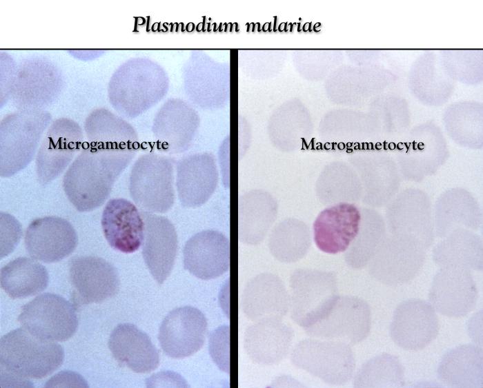 This thin film Giemsa stained micrograph depicts a Plasmodium malariae micro- (Lt) and macrogametocyte Adapted from Public Health Image Library (PHIL), Centers for Disease Control and Prevention.[6]