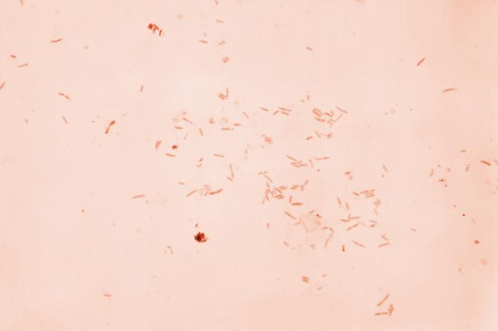 Gram-stained photomicrograph reveals the presence of numerous Gram-negative Plesiomonas shigelloides bacteria. From Public Health Image Library (PHIL). [2]