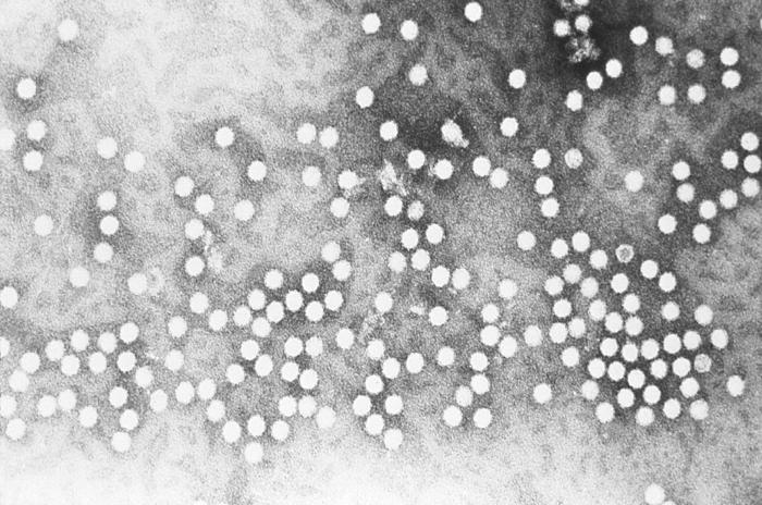 Electron micrograph depicts a number of parvovirus H-1 virions of the Parvoviridae family of DNA viruses. From Public Health Image Library (PHIL). [1]