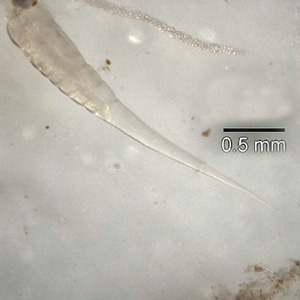 Posterior end of the worm in Figure 4. Note the long, slender pointed tail. Adapted from CDC