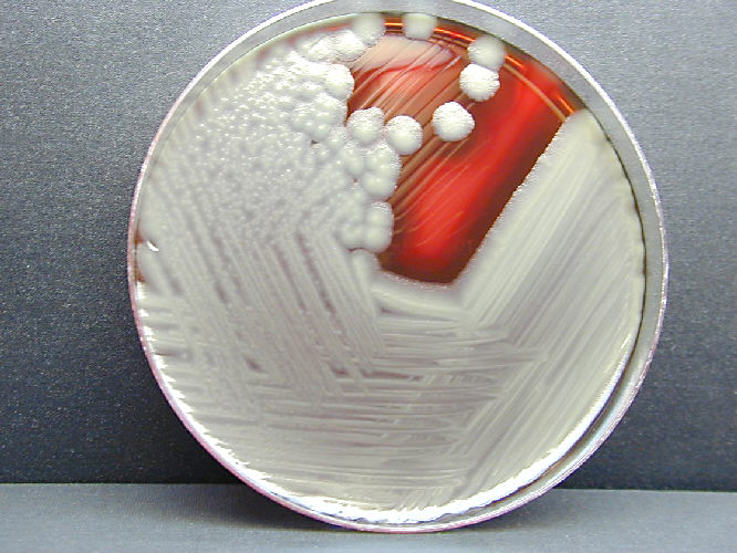 Bacillus cereus showing hemolysis on sheep blood agar. From Public Health Image Library (PHIL). [9]