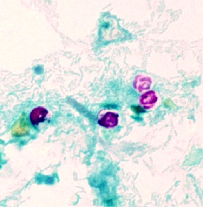Morphologic details of Cryptosporidium parvum oocysts, i.e.,encapsulated zygotes, stained using the modified acid-fast method. From Public Health Image Library (PHIL). [1]