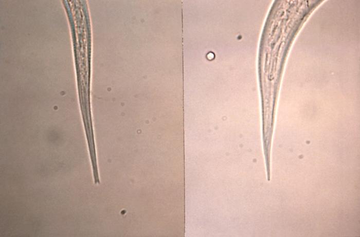 Micrograph depicting the tail tip of a Strongyloides filariform infective stage larvae on the left, and a hookworm on the right. From Public Health Image Library (PHIL). [1]