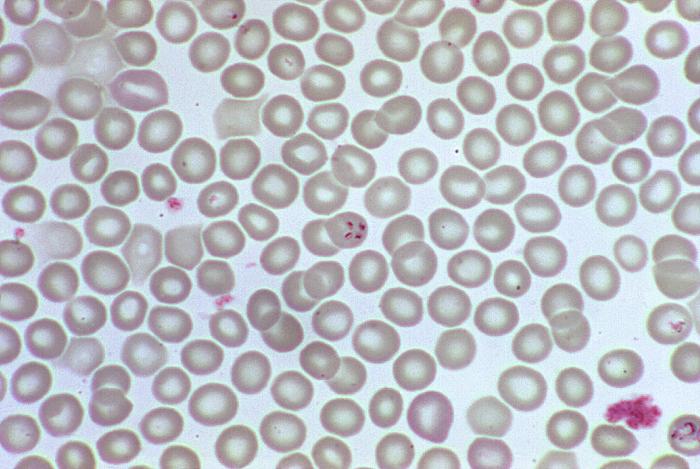 Note the developmental “tetrad” configuration of these Babesia sp. trophozoites, which resemble P. falciparum. From Public Health Image Library (PHIL). [2]
